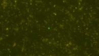 A microbial cell (center of the picture) detected from a sediment core sample at the depth of 1176.8 m at 120 degrees Celsius. Scale bar - 20 μm. Image credit: JAMSTEC / IODP.