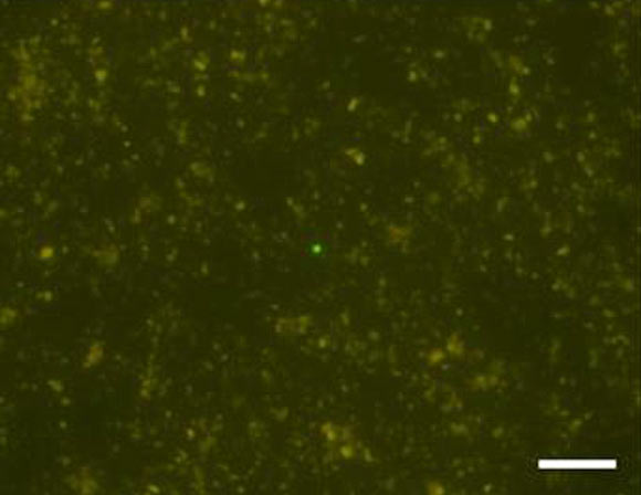 A microbial cell (center of the picture) detected from a sediment core sample at the depth of 1176.8 m at 120 degrees Celsius. Scale bar - 20 μm. Image credit: JAMSTEC / IODP.