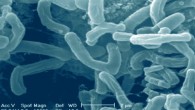 Bifidobacterium longum APC1472 has promising potential to be developed as a valuable supplement in reducing specific markers of obesity and is poised to have significant relevance in conditions of heightened blood glucose, such as type 2 diabetes. Image credit: Ali et al., doi: 10.5281/zenodo.1333400.