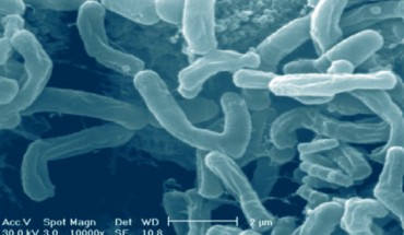 Bifidobacterium longum APC1472 has promising potential to be developed as a valuable supplement in reducing specific markers of obesity and is poised to have significant relevance in conditions of heightened blood glucose, such as type 2 diabetes. Image credit: Ali et al., doi: 10.5281/zenodo.1333400.