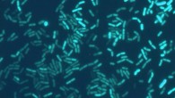 Bacillus subtilis. Image credit: Ákos Kovács, Technical University of Denmark.