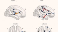 Increased subnetworks in absolute pitch musicians compared to non-musicians obtained in the whole-brain network-based statistic (NBS) analysis for resting-state functional connectivity (A) and diffusion weighted imaging (DWI)-based structural connectivity (B). Abbreviations: ACC - anterior cingulate cortex; AP - absolute pitch; aSMG - anterior supramarginal gyrus; aSTG - anterior superior temporal gyrus; cOp - central operculum; fOp - frontal operculum; FP - frontal pole; HG - Heschl’s gyrus; IFG, po - inferior frontal gyrus, pars opercularis; L - left; MTG - middle temporal gyrus; PCC - posterior cingulate cortex; postCG - postcentral gyrus; preCG - precentral gyrus; pSTG - superior temporal gyrus, posterior division; pOp - parietal operculum; PP - planum polare; PT - planum temporale; ptFG - posterior temporal fusiform gyrus; R - right; toFG - temporal occipital fusiform gyrus; TP - temporal pole. Image credit: Leipold et al., doi: 10.1523/JNEUROSCI.1985-20.2020.