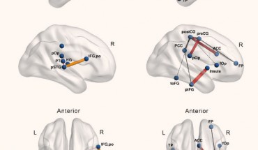 Increased subnetworks in absolute pitch musicians compared to non-musicians obtained in the whole-brain network-based statistic (NBS) analysis for resting-state functional connectivity (A) and diffusion weighted imaging (DWI)-based structural connectivity (B). Abbreviations: ACC - anterior cingulate cortex; AP - absolute pitch; aSMG - anterior supramarginal gyrus; aSTG - anterior superior temporal gyrus; cOp - central operculum; fOp - frontal operculum; FP - frontal pole; HG - Heschl’s gyrus; IFG, po - inferior frontal gyrus, pars opercularis; L - left; MTG - middle temporal gyrus; PCC - posterior cingulate cortex; postCG - postcentral gyrus; preCG - precentral gyrus; pSTG - superior temporal gyrus, posterior division; pOp - parietal operculum; PP - planum polare; PT - planum temporale; ptFG - posterior temporal fusiform gyrus; R - right; toFG - temporal occipital fusiform gyrus; TP - temporal pole. Image credit: Leipold et al., doi: 10.1523/JNEUROSCI.1985-20.2020.