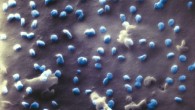 This helium ion microscope image shows SARS-CoV-2 virus particles (blue). Image credit: N. Frese / Bielefeld University.