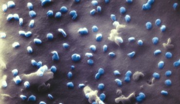 This helium ion microscope image shows SARS-CoV-2 virus particles (blue). Image credit: N. Frese / Bielefeld University.