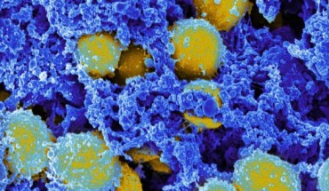 This digitally colorized, scanning electron microscopic (SEM) image, depicts a clump of yellow-colored, spheroid shaped, Staphylococcus aureus bacteria that were enmeshed in a blue-colored, filamentous extracellular matrix, which normally binds cells together within the body’s various tissue types Image credit: National Institute of Allergy and Infectious Diseases.
