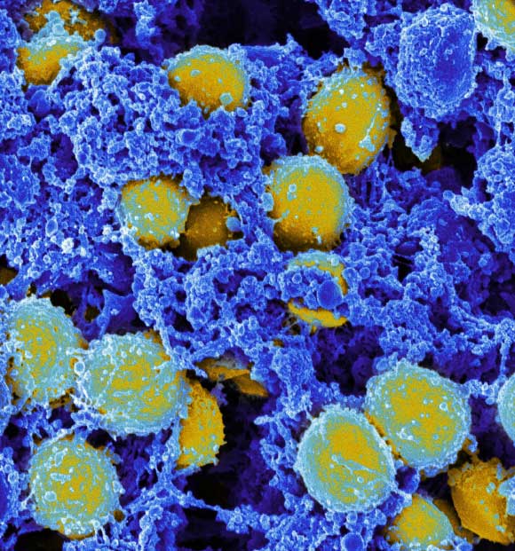 This digitally colorized, scanning electron microscopic (SEM) image, depicts a clump of yellow-colored, spheroid shaped, Staphylococcus aureus bacteria that were enmeshed in a blue-colored, filamentous extracellular matrix, which normally binds cells together within the body’s various tissue types Image credit: National Institute of Allergy and Infectious Diseases.