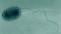 Transmission electron micrograph showing the general cell morphology of Methylobacterium jeotgali. Image credit: Aslam et al., doi: 10.1099/ijs.0.64625-0.