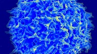 Scanning electron micrograph of a human T cell. Image credit: NIAID.