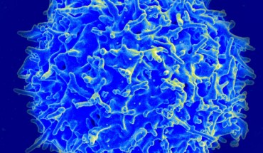Scanning electron micrograph of a human T cell. Image credit: NIAID.