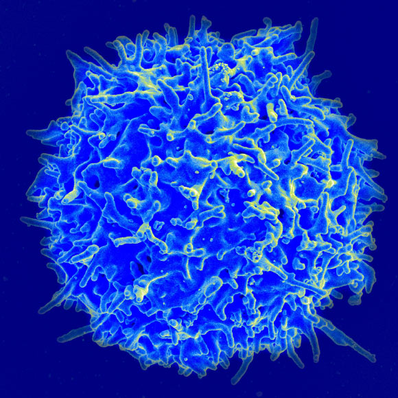 Scanning electron micrograph of a human T cell. Image credit: NIAID.