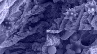 Streptococcus agalactiae (round spheres) on the surface of the bladder where they encounter urine to make their DNA. Image credit: Glen Ulett.