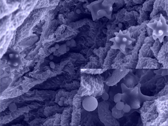 Streptococcus agalactiae (round spheres) on the surface of the bladder where they encounter urine to make their DNA. Image credit: Glen Ulett.