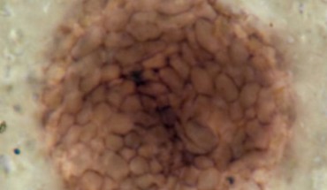 Bicellum brasieri. Image credit: Strother et al., doi: 10.1016/j.cub.2021.03.051.