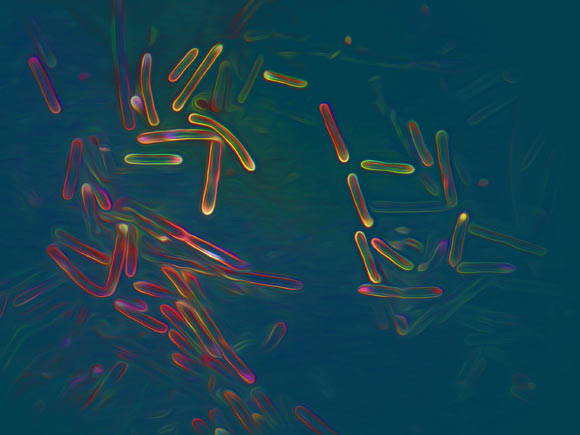 Anthocerotibacter panamensis. Image credit: Fay-Wei Li.