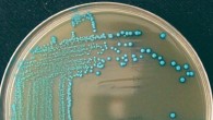 Listeria cossartiae is named for Pascale Cossart, a bacteriologist at the Pasteur Institute of Paris. Image credit: Catharine Carlin, Cornell University.
