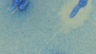 The JH1078 strain of Metarhizium brunneum. Image credit: Han et al., doi: 10.1038/s41598-021-89811-2.