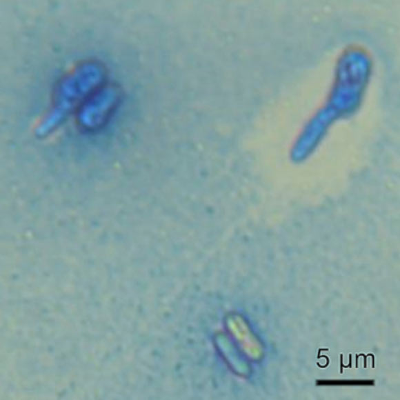 The JH1078 strain of Metarhizium brunneum. Image credit: Han et al., doi: 10.1038/s41598-021-89811-2.