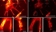 Speckle-MAIN imaging of Cos-7 cells: (a) diffraction-limited image; scale bar - 20 μm; (b) reconstructed speckle-MAIN image; (c, d) zoom-in view of the white box area in (a); (e, f) zoom-in view of the white box area in (b); scale bar: 2 μm. Image credit: Lee et al., doi: 10.1038/s41467-021-21835-8.