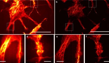Speckle-MAIN imaging of Cos-7 cells: (a) diffraction-limited image; scale bar - 20 μm; (b) reconstructed speckle-MAIN image; (c, d) zoom-in view of the white box area in (a); (e, f) zoom-in view of the white box area in (b); scale bar: 2 μm. Image credit: Lee et al., doi: 10.1038/s41467-021-21835-8.