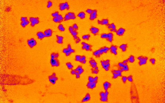 The spread of 46 human chromosomes. Image credit: Bhatiya et al., doi: 10.1007/s10577-021-09660-7.