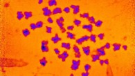 The spread of 46 human chromosomes. Image credit: Bhatiya et al., doi: 10.1007/s10577-021-09660-7.