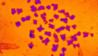 The spread of 46 human chromosomes. Image credit: Bhatiya et al., doi: 10.1007/s10577-021-09660-7.