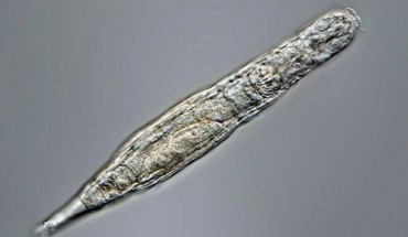 A bdelloid rotifer. Image credit: Michael Plewka.