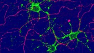 A glial cell of new type (green), arising from adult stem cells in the brain, contacts nerve cells (magenta). Image credit: Biozentrum, University of Basel.