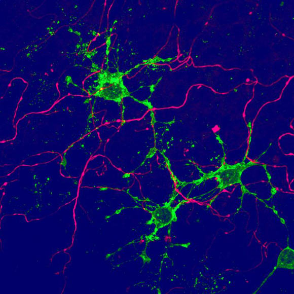 A glial cell of new type (green), arising from adult stem cells in the brain, contacts nerve cells (magenta). Image credit: Biozentrum, University of Basel.