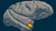 An area (red-yellow) in the brain’s temporal pole specializes in familiar face recognition. Image credit: Sofia Landi.