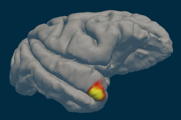 An area (red-yellow) in the brain’s temporal pole specializes in familiar face recognition. Image credit: Sofia Landi.
