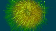 Gloeotrichia echinulata, a colonial species of cyanobacteria. Image credit: Barry Rosen, U.S. Geological Survey.