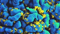 Scanning electron micrograph of an HIV-infected H9 T cell. Image credit: NIAID.