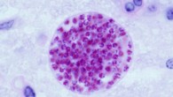 Microscopic cysts containing Toxoplasma gondii develop in the tissues of many vertebrates. Here, in mouse brain tissue, thousands of bradyzoites (stained red) are enveloped by a thin parasite cyst wall. Image credit: Jitinder P. Dubey.