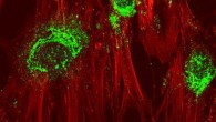 Magnified image showing adult stem cells in the process of turning into bone cells after treatment with high-frequency sound waves. Green coloring shows the presence of collagen, which the cells produce as they become bone cells. Magnification - 60x. Image credit: RMIT University.