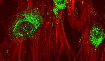 Magnified image showing adult stem cells in the process of turning into bone cells after treatment with high-frequency sound waves. Green coloring shows the presence of collagen, which the cells produce as they become bone cells. Magnification - 60x. Image credit: RMIT University.