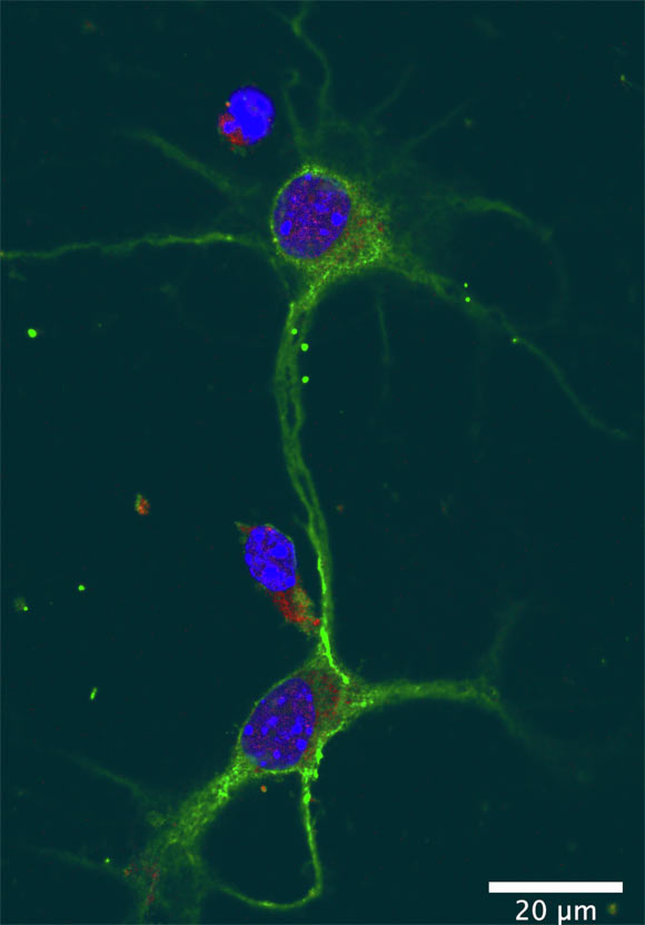 This image shows subcellular localization of ADRAM (red) in primary cortical neurons. Scale bar - 20 μm. Image credit: Wei et al., doi: 10.1016/j.celrep.2022.110546.