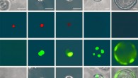 Human ES cell derived RASC transitioning to an Alveolar type 2 cell over time in culture. Image credit: Basil et al., doi: 10.1038/s41586-022-04552-0.