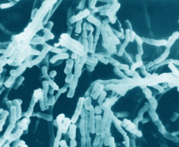 Scanning electron micrograph showing rod-shaped fragments of the aerial mycelium of Lentzea flaviverrucosa grown on modified Sauton’s agar for 8 days at 28 degrees Celsius. Magnification 8,000x. Image credit: Xie et al., doi: 10.1099/00207713-52-5-1815.