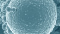 Asgard archaeon. Scale bar - 500 nm. Image credit: Imachi et al., doi: 10.1038/s41586-019-1916-6.