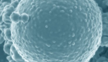 Asgard archaeon. Scale bar - 500 nm. Image credit: Imachi et al., doi: 10.1038/s41586-019-1916-6.