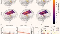 Healthy brain temperature varies by time of day. Image credit: Rzechorzek et al., doi: 10.1093/brain/awab466.