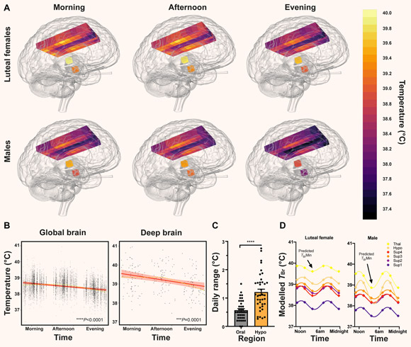 Healthy brain temperature varies by time of day. Image credit: Rzechorzek et al., doi: 10.1093/brain/awab466.