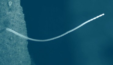 Single filament of Ca. Thiomargarita magnifica. Image credit: Jean-Marie Volland.
