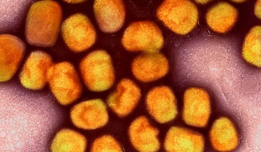 Colorized transmission electron micrograph of monkeypox virus particles (gold) cultivated and purified from cell culture. Image credit: NIAID.