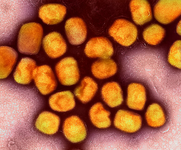 Colorized transmission electron micrograph of monkeypox virus particles (gold) cultivated and purified from cell culture. Image credit: NIAID.