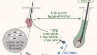 Liu et al. show that in normal mouse skin, Scube3 is expressed only in dermal papillae of growing, but not in resting follicles. SCUBE3 protein microinjection is sufficient to induce new hair growth, and pharmacological TGF-β inhibition rescues mutant hair hyper-activation phenotype. Moreover, dermal-papilla-enriched expression of SCUBE3 and its growth-activating effect are partially conserved in human scalp hair follicles. Image credit: Liu et al., doi: 10.1016/j.devcel.2022.06.005.