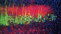 Zhou et al. discovered sound reduces pain in mice by lowering the activity of neurons in the brain’s auditory cortex (green and magenta) that project to the thalamus. Image credit: Wenjie Zhou.