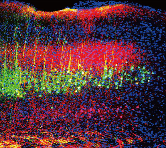 Zhou et al. discovered sound reduces pain in mice by lowering the activity of neurons in the brain’s auditory cortex (green and magenta) that project to the thalamus. Image credit: Wenjie Zhou.